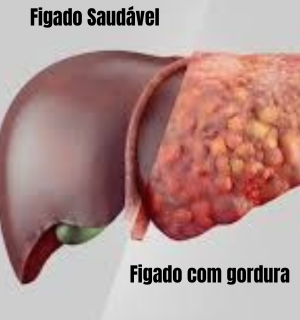 figado inflamado com um figgado saudavel